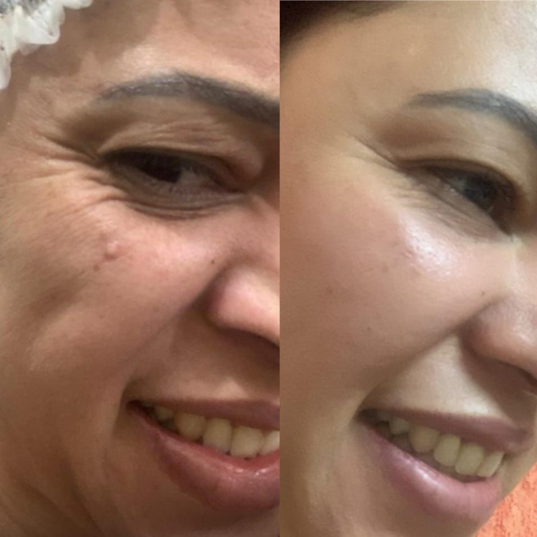 Resultado 1